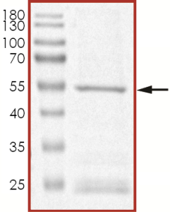 JAK2 (JH2) (V617F W659A W777A F794H) Protein